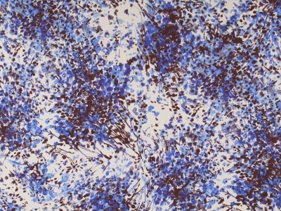 Poly Sorella fabric painted pattern 2 colors
