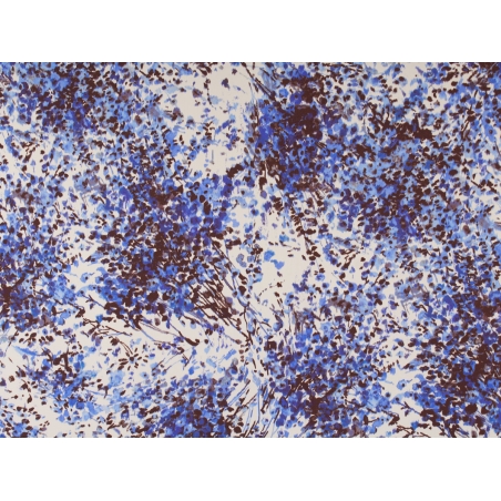Poly Sorella fabric painted pattern 2 colors